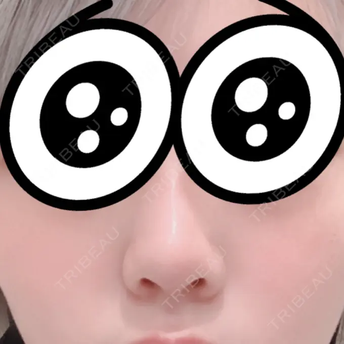 軟骨移植 GLANZ CLINIC BEFORE メイン用