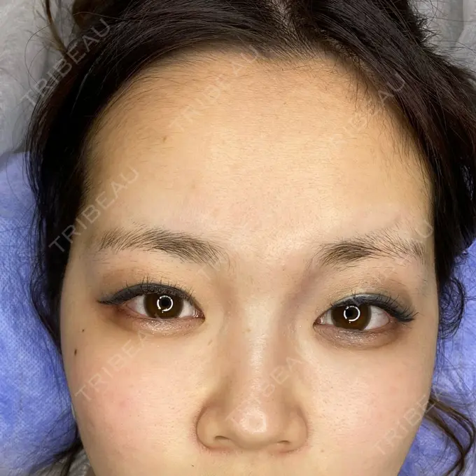 アートメイク（眉） 表参道ウィズ・クリニック BEFORE メイン用