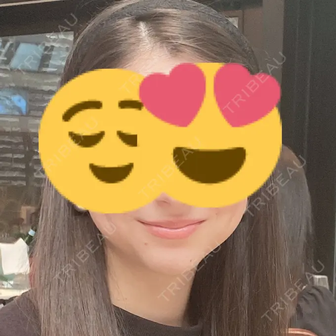 ボトックス（エラ・小顔） / その他（輪郭） もとび美容外科クリニック 新宿院 BEFORE メイン用