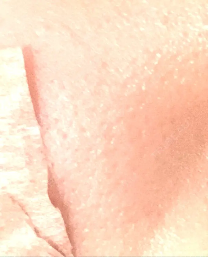 美容点滴・美容注射（美肌） / その他（肌） チョンダムジュエンクリニック BEFORE メイン用