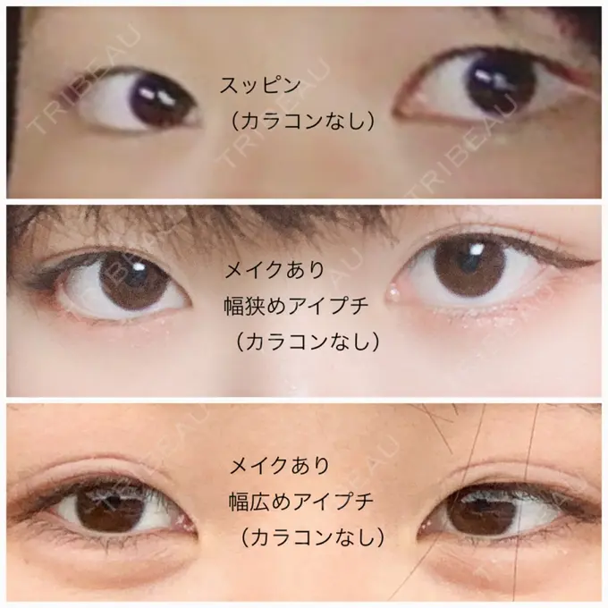 二重埋没 湘南美容クリニック 長野院 BEFORE メイン用