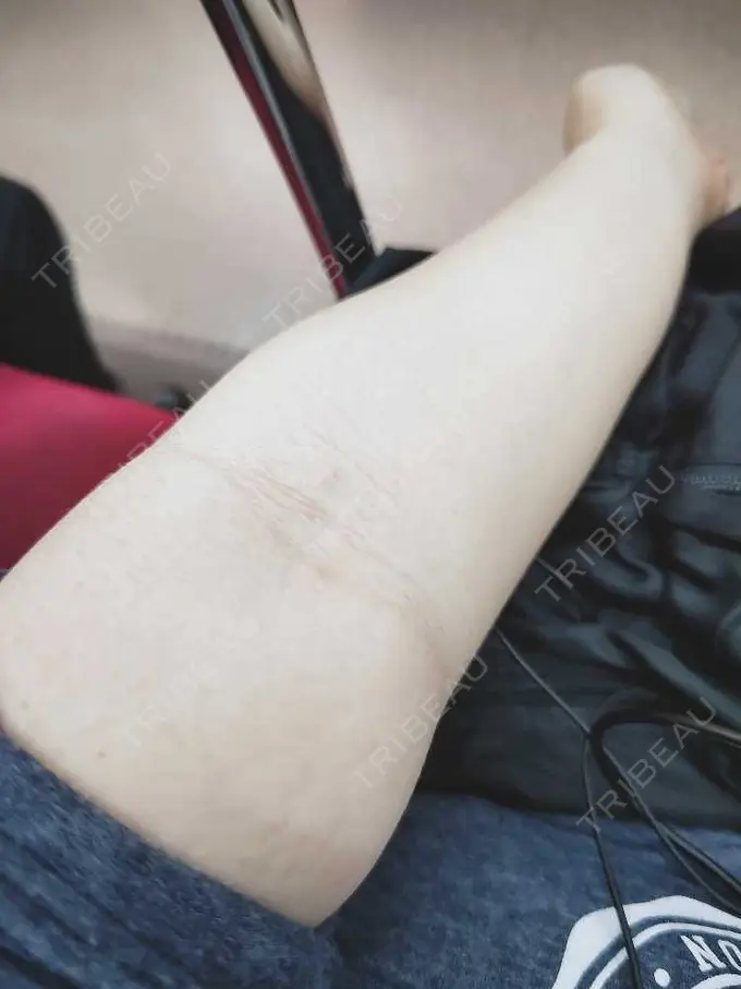 美容点滴・美容注射（美肌） / 美容点滴・美容注射（ダイエット） / 美容点滴・美容注射（疲労回復） 銀座美容外科クリニック 新宿院 BEFORE メイン用