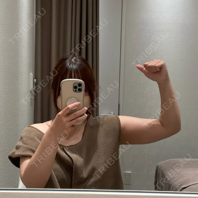 脂肪吸引（二の腕） / 脂肪吸引（肩） / ボトックス（肩） / ボトックス（首） Mods Clinic（モッズクリニック） 東京院 BEFORE メイン用