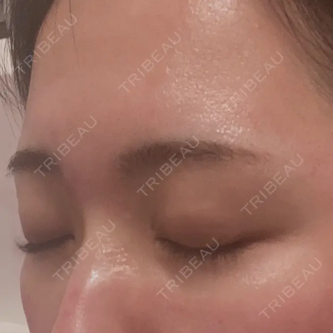 アートメイク（眉） APスキンクリニック銀座 BEFORE メイン用