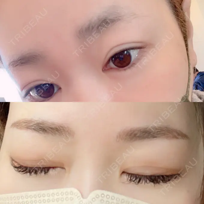 アートメイク（眉） 表参道ウィズ・クリニック BEFORE メイン用