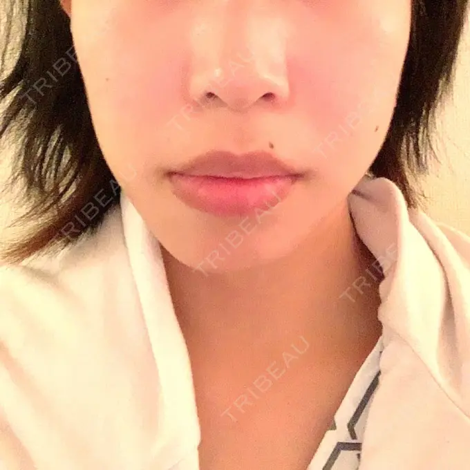 セットバック 大塚美容形成外科・歯科 大塚本院 BEFORE メイン用