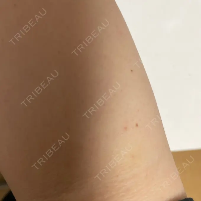 美容点滴・美容注射（ダイエット） 東京美容外科 大宮院 BEFORE メイン用