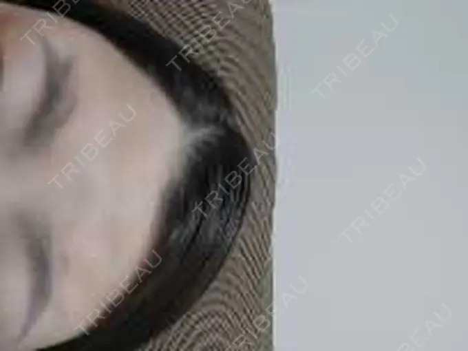 ボトックス（エラ・小顔） / ボトックス（眉間） / ボトックス（額） ルラ美容クリニック 池袋院 BEFORE メイン用