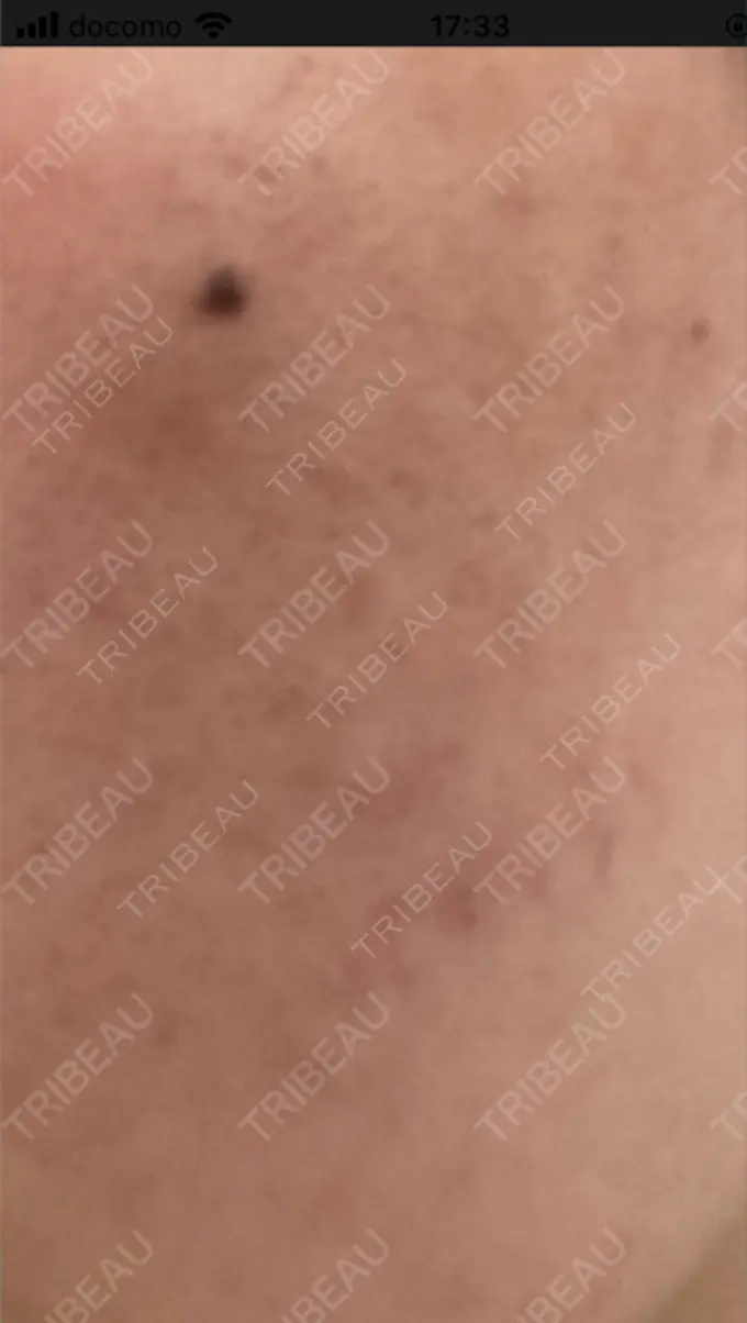 アグネス つばめ美容クリニック BEFORE メイン用