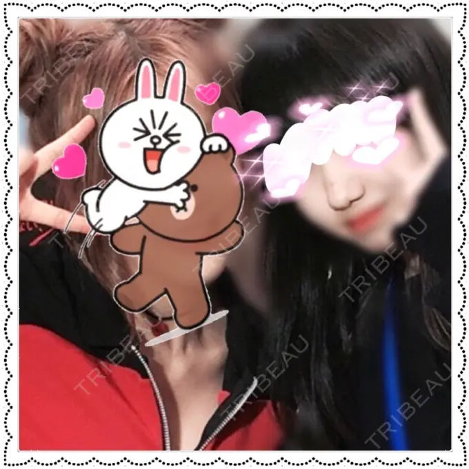 小鼻縮小（切開） Dual Clinic KOBE BEFORE メイン用