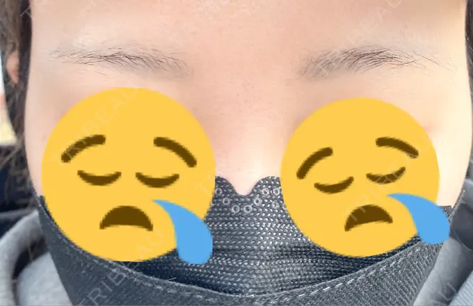 アートメイク（眉） アモーレクリニック 名古屋院 BEFORE メイン用