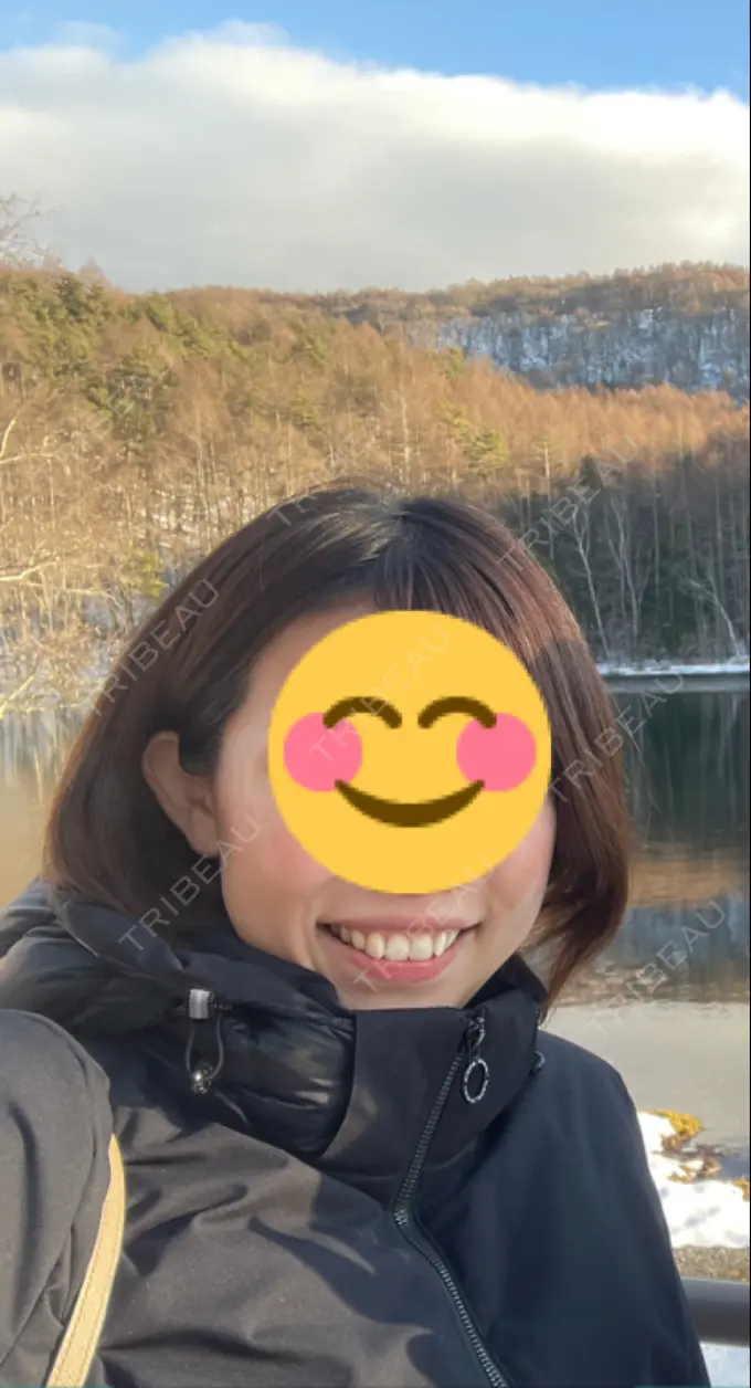 ホワイトニング SK新宿歌舞伎町美容外科・歯科 BEFORE メイン用