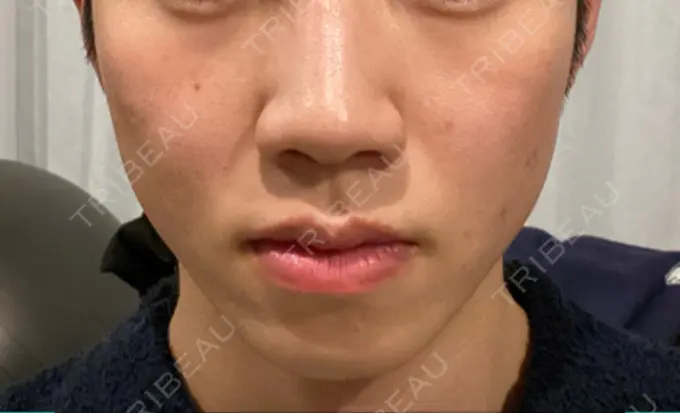 ポテンツァ Otus Clinic 【オータスクリニック】 BEFORE メイン用