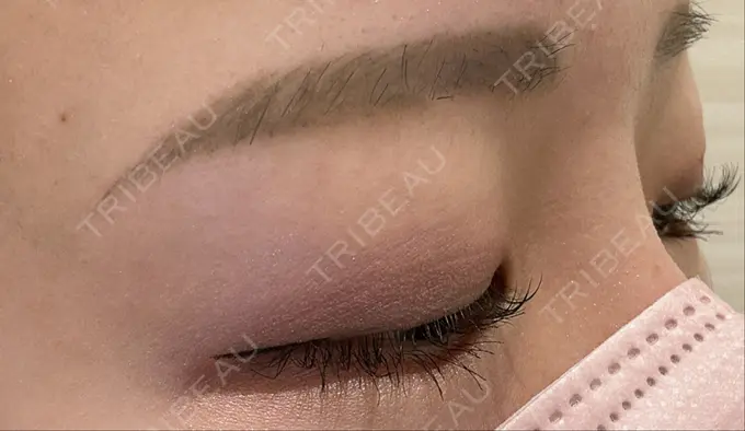 ほくろ・いぼ切除（肌） ルラ美容クリニック 渋谷本院 BEFORE メイン用