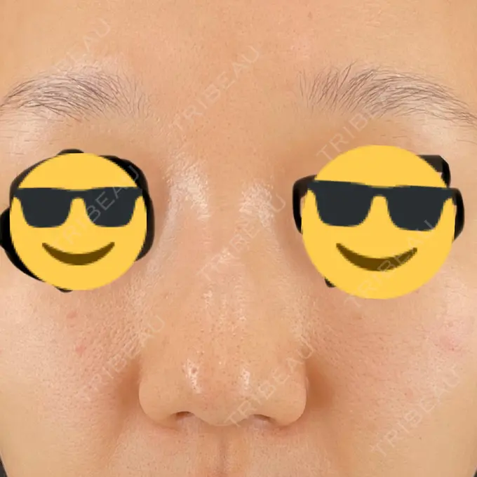 ポテンツァ Otus Clinic 【オータスクリニック】 BEFORE メイン用