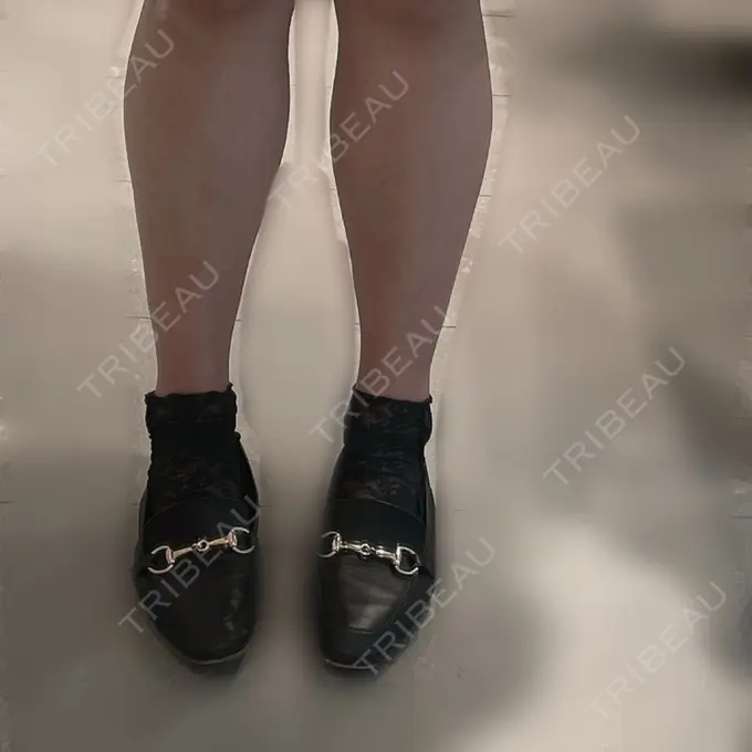 ボトックス（ふくらはぎ） LEAGRANT CLINIC 中目黒 BEFORE メイン用