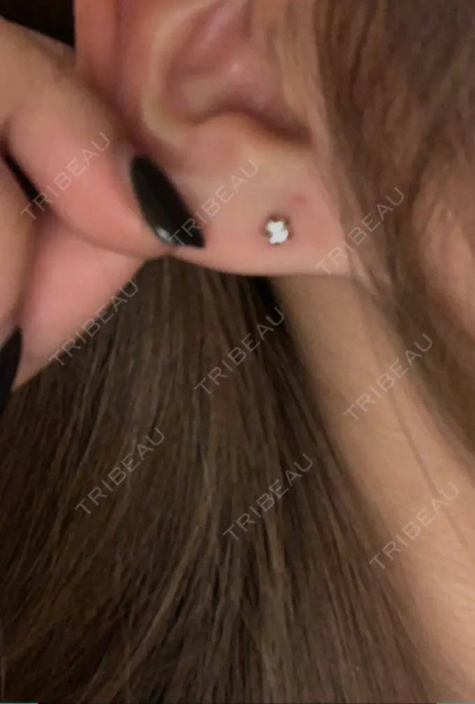 ピアス穴あけ アイ&スキンクリニック東京ソラマチ BEFORE メイン用