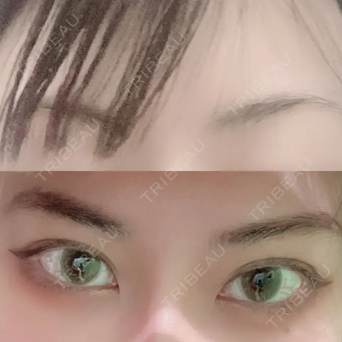 その他（肌） / アートメイク（眉） アモーレクリニック 名古屋院 BEFORE メイン用