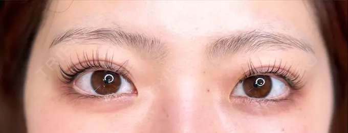 アートメイク（眉） ハナビューティークリニック BEFORE メイン用