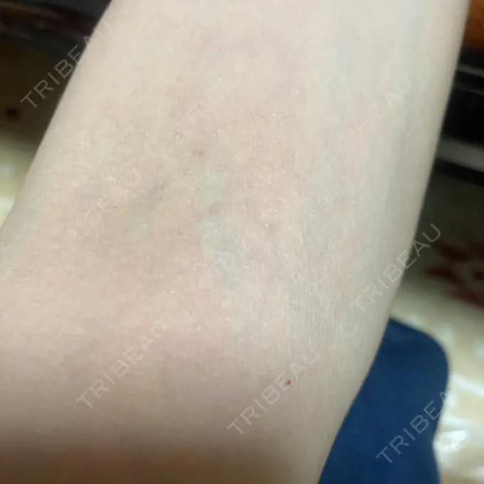 白玉点滴・注射 椿クリニック 心斎橋院 BEFORE メイン用