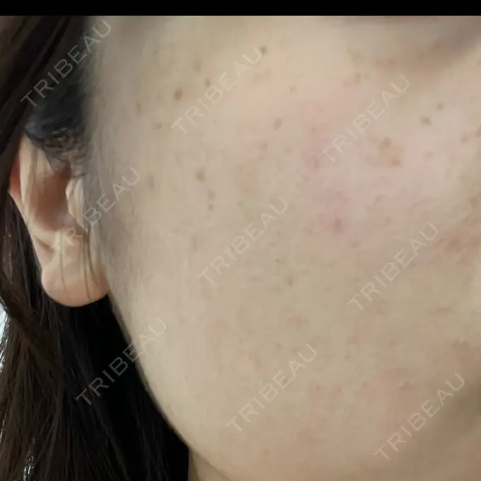 ルメッカ 豊洲内科・糖尿病 / 形成・美容外科クリニック BEFORE メイン用