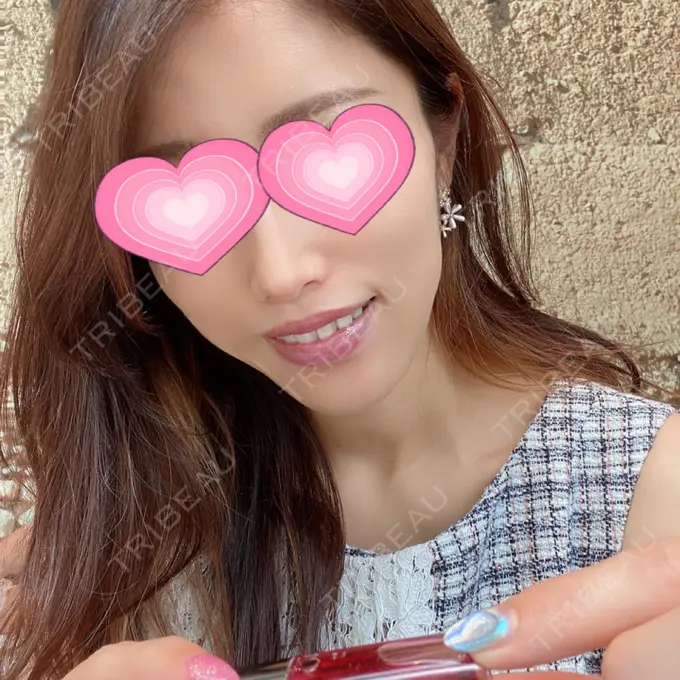 リジュラン ルラ美容クリニック 渋谷本院 BEFORE メイン用