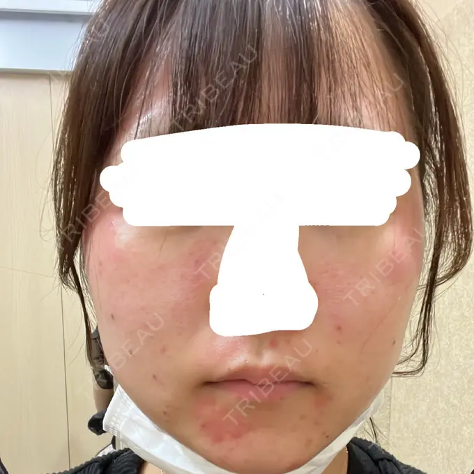 ルメッカ 豊洲内科・糖尿病 / 形成・美容外科クリニック BEFORE メイン用