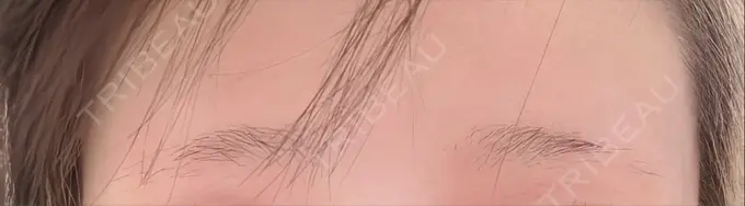 アートメイク（眉） 表参道メディカルクリニック 名古屋院 BEFORE メイン用