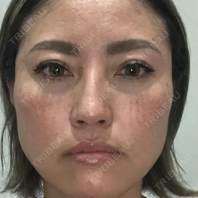 ルメッカ 豊洲内科・糖尿病 / 形成・美容外科クリニック BEFORE メイン用