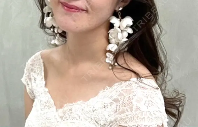 ボトックス（エラ・小顔） / ボトックス（肩） / ハイフ（顔） LOUIS CLINIC 二子玉川院【ルイクリニック】 BEFORE メイン用