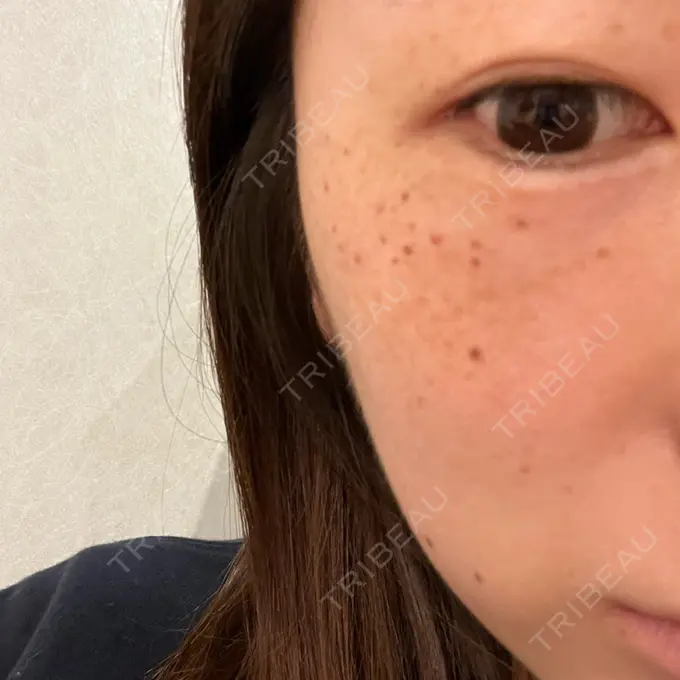 ルメッカ 豊洲内科・糖尿病 / 形成・美容外科クリニック BEFORE メイン用