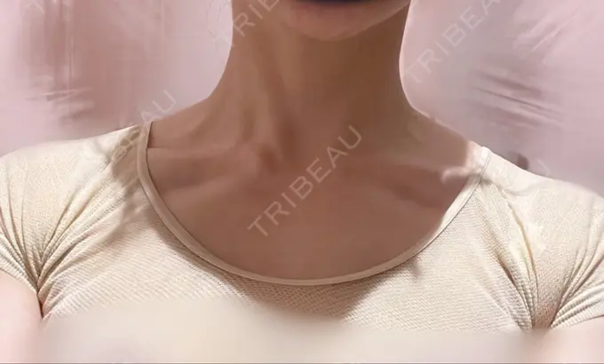 ボトックス（肩） LOUIS CLINIC 二子玉川院【ルイクリニック】 BEFORE メイン用