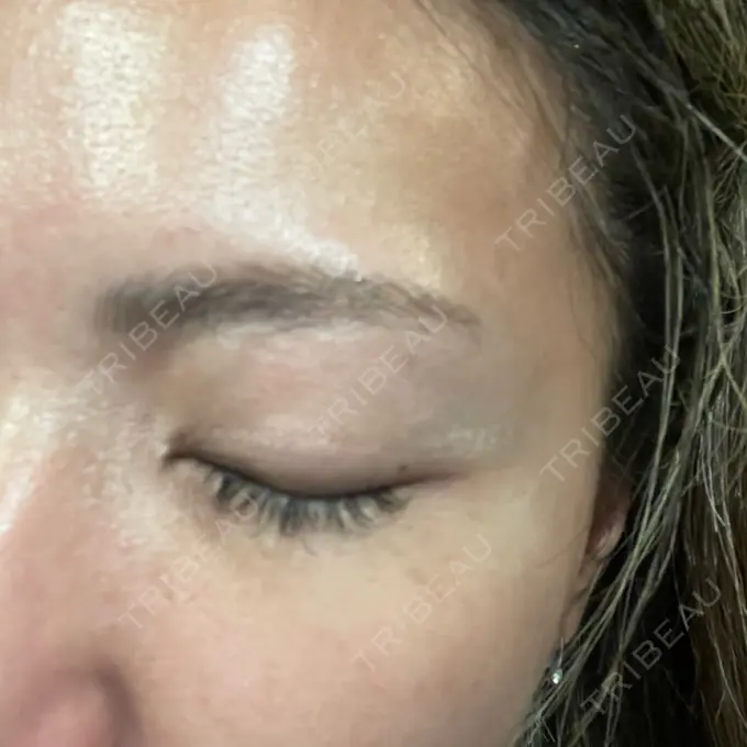 アートメイク（眉） 表参道メディカルクリニック 福岡天神院 BEFORE メイン用
