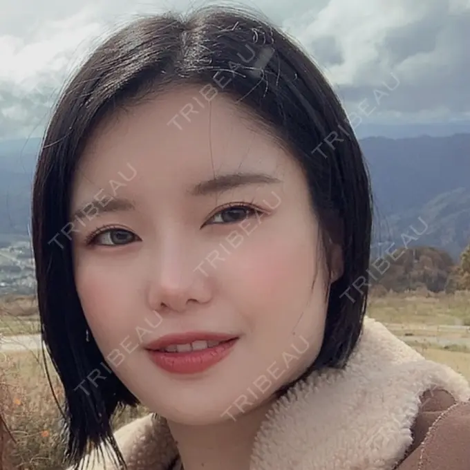 骨切り（あご） / 骨削り（エラ） / 骨削り（頬） id（アイディ）美容外科 BEFORE メイン用