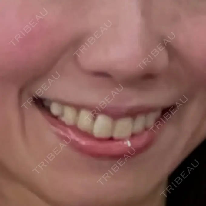 ポテンツァ A CLINIC（エークリニック） 横浜院 BEFORE メイン用