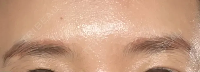 アートメイク（眉） Tokyo Tensei Clinic 新宿院 BEFORE メイン用