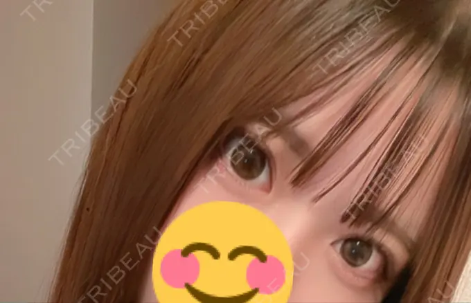 二重埋没 仙台TAクリニック BEFORE メイン用