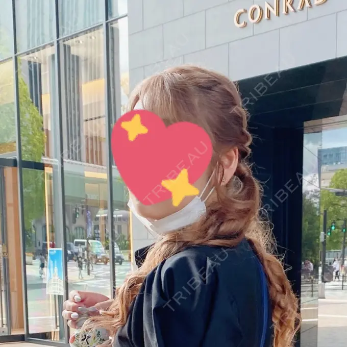 脂肪吸引（顔） / ボトックス（エラ・小顔） ルラ美容クリニック 大阪本院 BEFORE メイン用