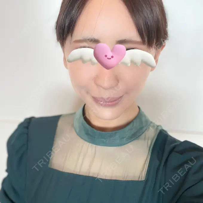 隆鼻術 / 糸リフト / 軟骨移植 / 脂肪注入（肌） / プロテーゼ除去 / 鼻修正 / 脂肪注入（額） / 脂肪注入（目の下） / その他（肌） id（アイディ）美容外科 BEFORE メイン用