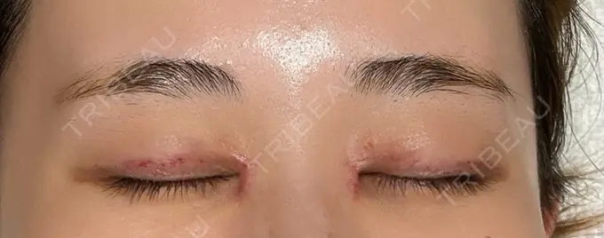 アートメイク（眉） にしまき美容スキンクリニック BEFORE メイン用