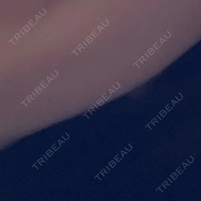 ハイフ（顔） Mavie Beauty Clinic （マヴィービューティークリニック） BEFORE メイン用