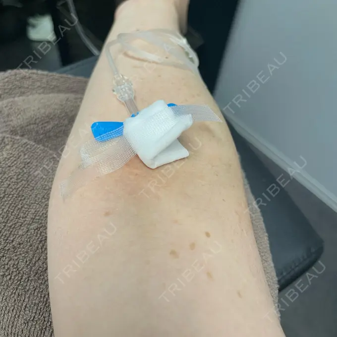 白玉点滴・注射 美容皮膚科エルムクリニック 麻布院 BEFORE メイン用