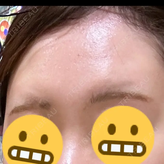 アートメイク（眉） Belle Via Skin Clinic BEFORE メイン用