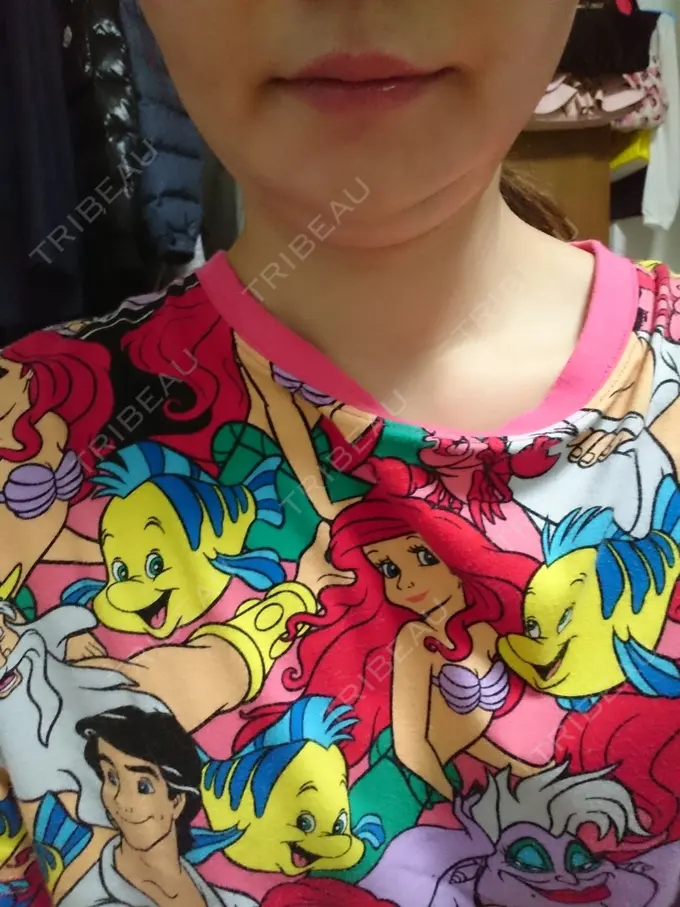 脂肪溶解注射（顔） ヴェリテクリニック 銀座院 BEFORE メイン用