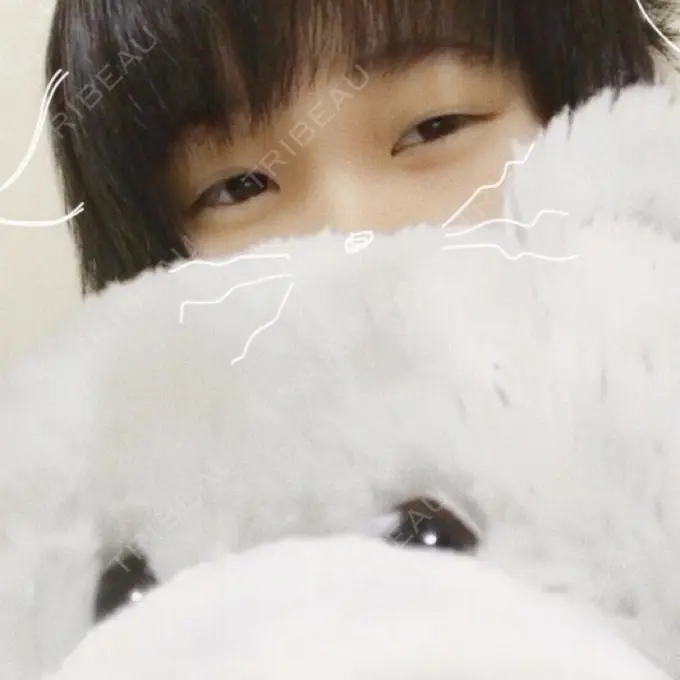 二重埋没 久留米総合美容外科 BEFORE メイン用