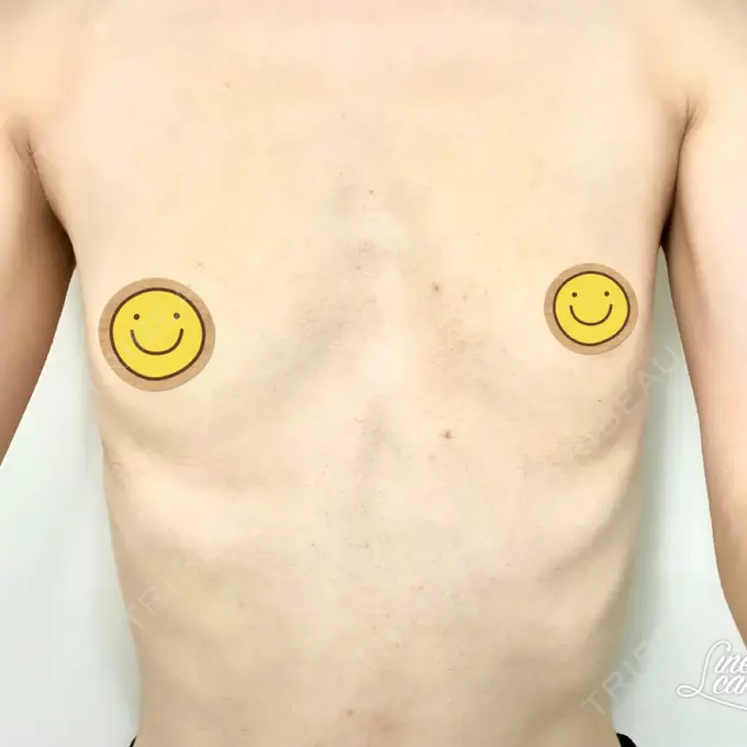 豊胸（シリコンバッグ） ジョウクリニック 那覇院 BEFORE メイン用