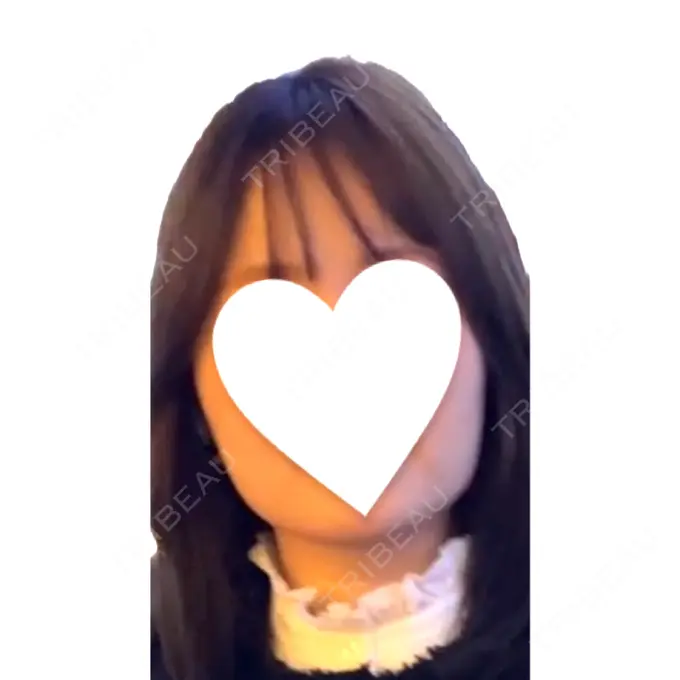 ボトックス（エラ・小顔） / ボトックス（肩） / ワキ汗治療（ボトックス） DMTC CLINIC 日本橋院 BEFORE メイン用