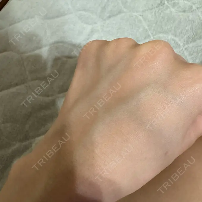 白玉点滴・注射 城本クリニック 名古屋院 BEFORE メイン用