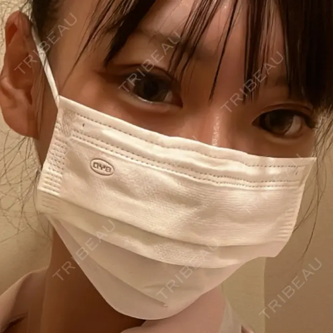 二重埋没 日本ウェルネス再生クリニック BEFORE メイン用