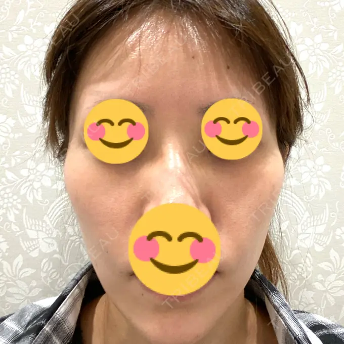 その他（肌） 東京中央クリニック BEFORE メイン用